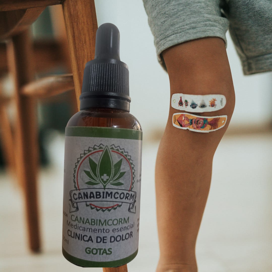 CBD para migrañas en mujeres